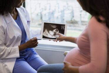 ultra sound scanning